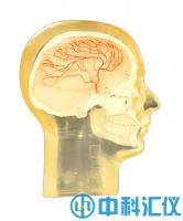 美國RSD 血管造影頭部模型